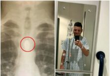 Chuyện đi Mỹ khám bệnh