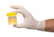 Chuẩn đoán bệnh qua nước tiểu