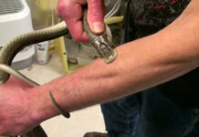 Người bị rắn độc cắn trăm lần không chết