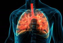 Top 7 căn bệnh truyền nhiễm kinh hoàng nhất lịch sử loài người