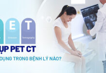 Quy trình chụp PET CT: Khi nào thực hiện, ứng dụng trong bệnh lý nào?