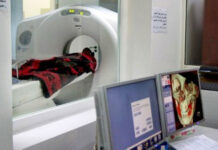 Chụp CT, trẻ có nguy cơ ung thư não cao