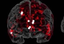 Sức sáng tạo của một người phụ thuộc vào thứ gì trong bộ não?