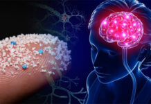 Hạt vi nhựa ngày càng xâm lấn vào não bộ của con người càng nhiều