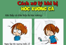 Cách xử lý “chuẩn không cần chỉnh” khi bị hóc xương cá