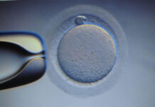 Thụ tinh ống nghiệm dễ ung thư buồng trứng