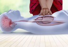 Bài hát của Taylor Swift giúp hồi sức tim phổi đúng cách