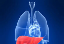 “Chiêu” mới trị ung thư gan