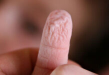 Vì sao ngón tay nhăn nheo khi ngâm nước?