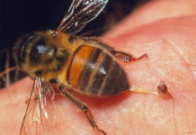 Cách xử lý khi bị ong đốt