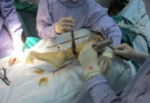 Phẫu thuật kéo dài chân diễn ra như thế nào?