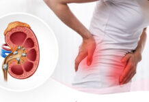 Nguyên nhân phổ biến gây sỏi tiết niệu bạn nên biết