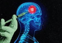 Có thể chống ung thư não bằng vaccine