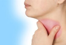 Cách chữa viêm họng hữu hiệu vào mùa đông