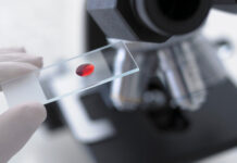 Chẩn đoán sớm ung thư tuyến tụy bằng một giọt máu