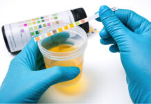 Các phương pháp xét nghiệm phát hiện chất gây nghiện