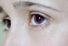 Truyền thuyết li kì về những người có đôi mắt tím