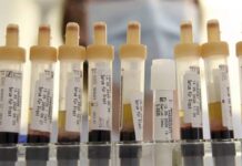 Những điều cần biết về nhóm máu mới: Gwada âm tính