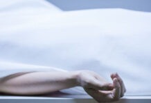 Cận cảnh quá trình biến đổi của cơ thể con người sau khi chết