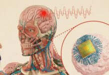 Chip não tiêm của MIT có thể điều trị bệnh mà không cần phẫu thuật