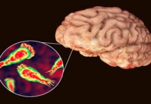 Rất có thể bạn đã bị nhiễm một loại virus ăn não mà bạn chưa từng nghe đến